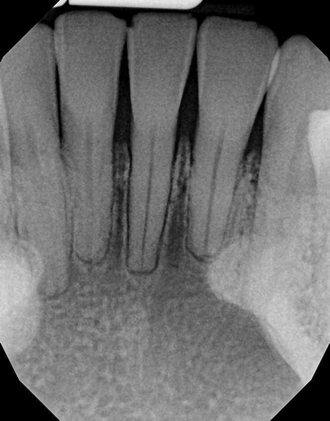 Anonymized dental X-ray included for educational illustration